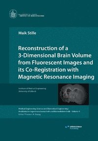 bokomslag Reconstruction of a 3-Dimensional Brain Volume from Fluorescent Images and its Co-Registration with Magnetic Resonance Imaging