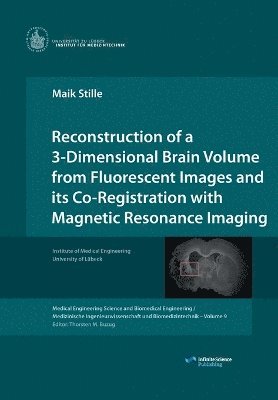 bokomslag Reconstruction of a 3-Dimensional Brain Volume from Fluorescent Images and its Co-Registration with Magnetic Resonance Imaging