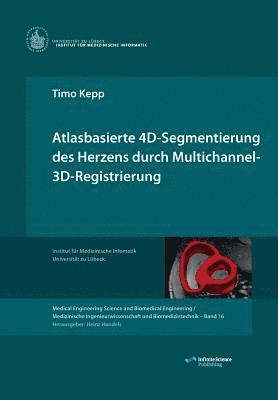 bokomslag Atlasbasierte 4D-Segmentierung des Herzens durch Multichannel 3D-Registrierung