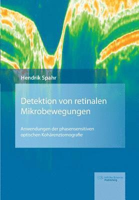 bokomslag Detektion von retinalen Mikrobewegungen