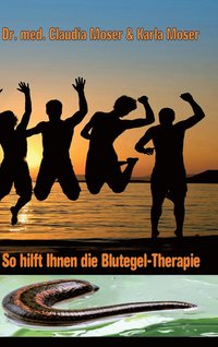 bokomslag So hilft ihnen die Blutegeltherapie