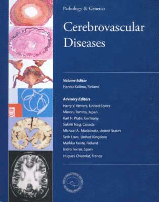 bokomslag Cerebrovascular Diseases