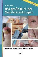 bokomslag Das große Buch der Nagelerkrankungen