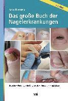 Das große Buch der Nagelerkrankungen 1