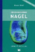 Der eingewachsenen Nagel