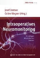 Intraoperatives Neuromonitoring 1