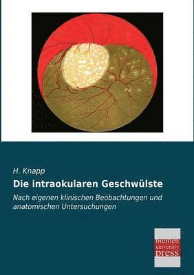 bokomslag Intraokularen Geschwulste