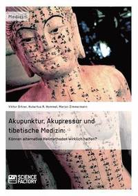 bokomslag Akupunktur, Akupressur und tibetische Medizin