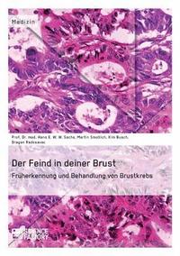 bokomslag Feind in deiner Brust. Früherkennung und Behandlung von Brustkrebs