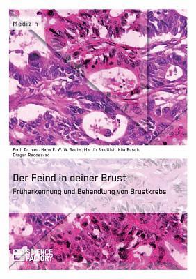 bokomslag Feind in deiner Brust. Früherkennung und Behandlung von Brustkrebs