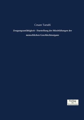 bokomslag Zeugungsunfhigkeit - Darstellung der Missbildungen der menschlichen Geschlechtsorgane