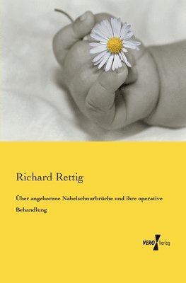 Richard Rettig - Über angeborene Nabelschnurbrüche und ihre operative Behandlung, Häftad