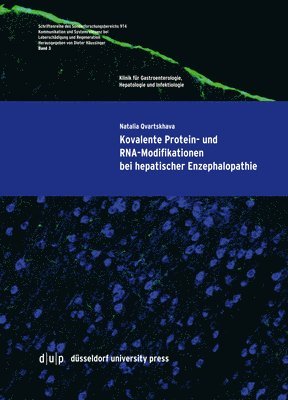 Natalia Qvartskhava - Kovalente Protein- und RNA-Modifikationen bei hepatischer Enzephalopathie, Häftad