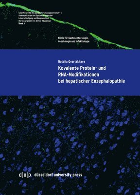 Kovalente Protein- und RNA-Modifikationen bei hepatischer Enzephalopathie 1