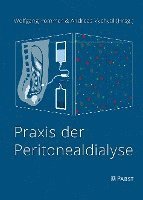 Wolfgang Pommer, Andreas Vychytil - PRAXIS Der Peritonealdialyse, Inbunden