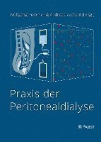 Praxis Der Peritonealdialyse 1