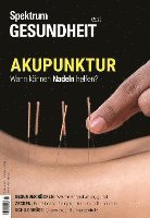 bokomslag Spektrum Gesundheit- Akupunktur