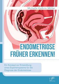 bokomslag Endometriose früher erkennen! Ein Konzept zur Entwicklung eines Expertensystems für die Diagnose der Endometriose