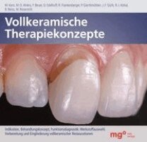 Matthias Kern, Martin Rosentritt, Josef Schweiger, Manfred Kern, M. Oliver Ahlers, Florian Beuer, Daniel Edelhoff, Petra Gierthmühlen, Jan-F. Güth, Roland Frankenberger, Ralf-J. Kohal, Bernd Reiss - Vollkeramische Therapiekonzepte, Inbunden