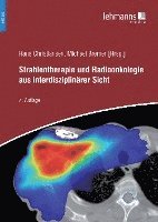 Strahlentherapie und Radioonkologie aus interdisziplinärer Sicht