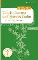 bokomslag Colitis ulcerosa und Morbus Crohn