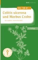 Jost Langhorst, Annette Kerckhoff - Colitis ulcerosa und Morbus Crohn, Häftad