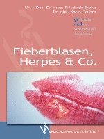 Fieberblasen, Herpes & Co 1