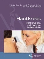 bokomslag Hautkrebs