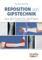 bokomslag Reposition und Gipstechnik II