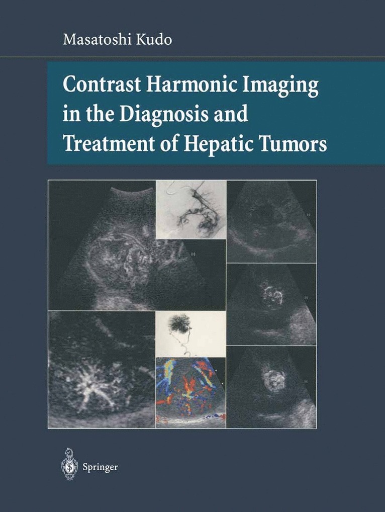 Masatoshi Kudo - Contrast Harmonic Imaging in the Diagnosis and Treatment of Hepatic Tumors, Inbunden