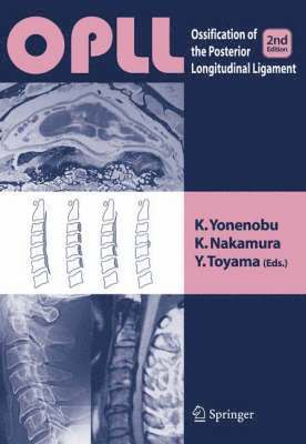 K. Yonenobu, K. Nakamura - OPLL: Ossification of Posterior Longitudinal Ligament, Inbunden