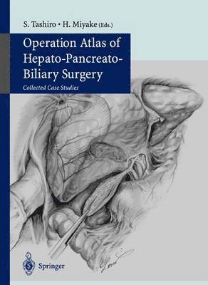 bokomslag Operation Atlas of Hepato-Pancreato-Biliary Surgery