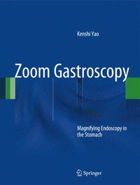 bokomslag Zoom Gastroscopy