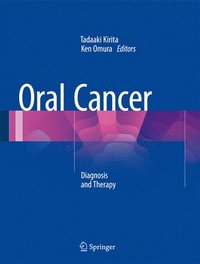bokomslag Oral Cancer