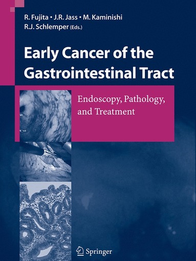 bokomslag Early Cancer of the Gastrointestinal Tract