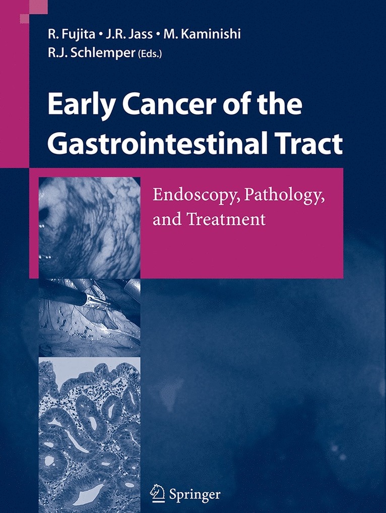 R. Fujita, J.R. Jass, M. Kaminishi, R.J. Schlemper, J. R. Jass, R. J. Schlemper - Early Cancer of the Gastrointestinal Tract, Häftad