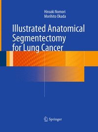 bokomslag Illustrated Anatomical Segmentectomy for Lung Cancer