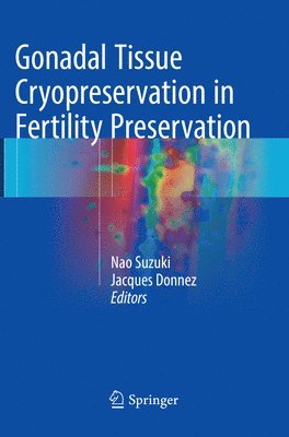 Gonadal Tissue Cryopreservation in Fertility Preservation 1
