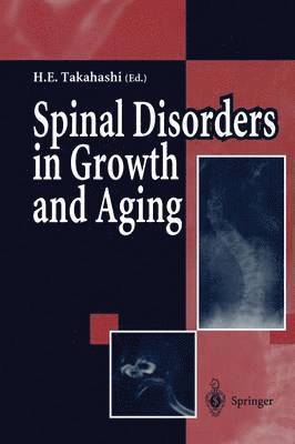 Hideaki E. Takahashi - Spinal Disorders in Growth and Aging, Häftad