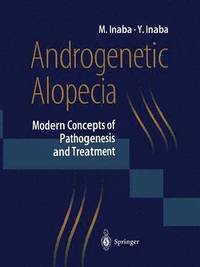 bokomslag Androgenetic Alopecia