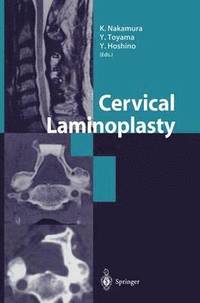 bokomslag Cervical Laminoplasty