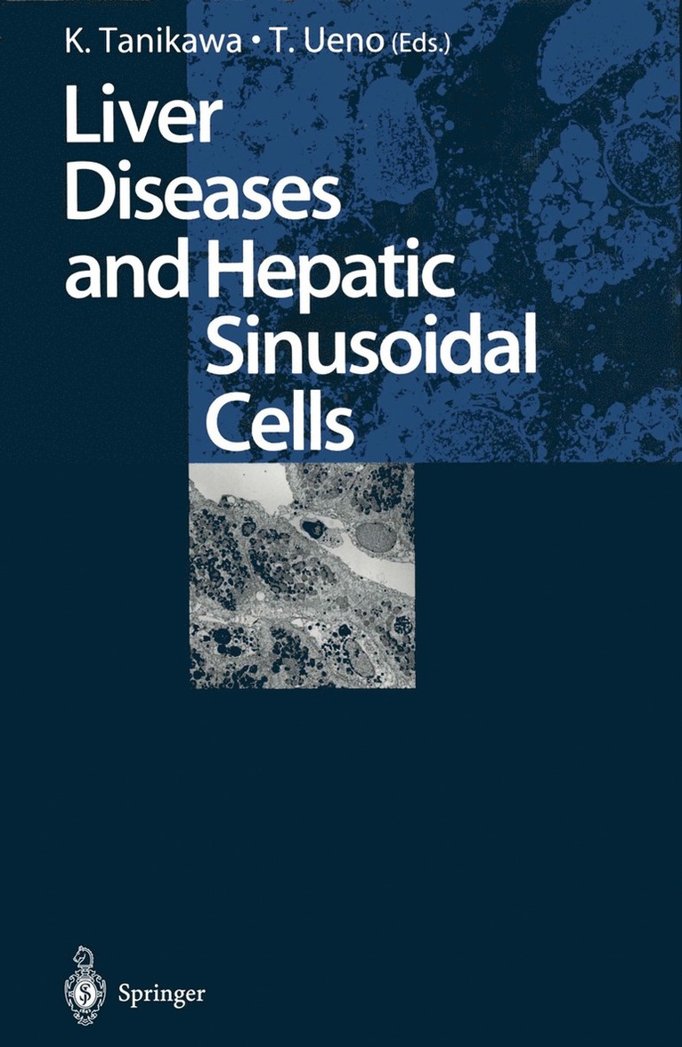 Kyuichi Tanikawa, Takato Ueno - Liver Diseases and Hepatic Sinusoidal Cells, Häftad
