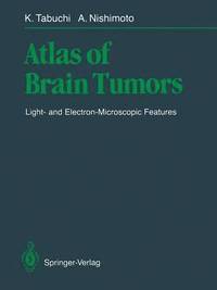 bokomslag Atlas of Brain Tumors