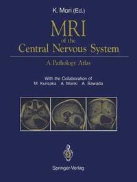 bokomslag MRI of the Central Nervous System
