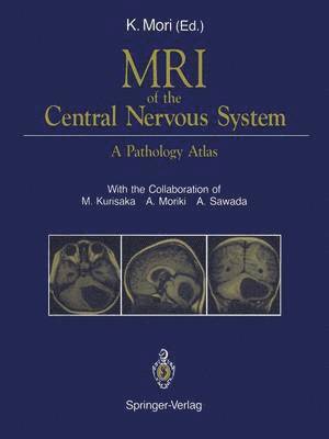 MRI of the Central Nervous System 1