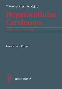 bokomslag Hepatocellular Carcinoma