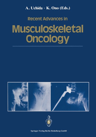 bokomslag Recent Advances in Musculoskeletal Oncology