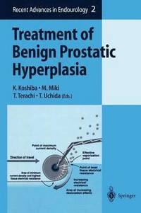 bokomslag Treatment of Benign Prostatic Hyperplasia