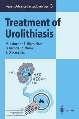 bokomslag Treatment of Urolithiasis