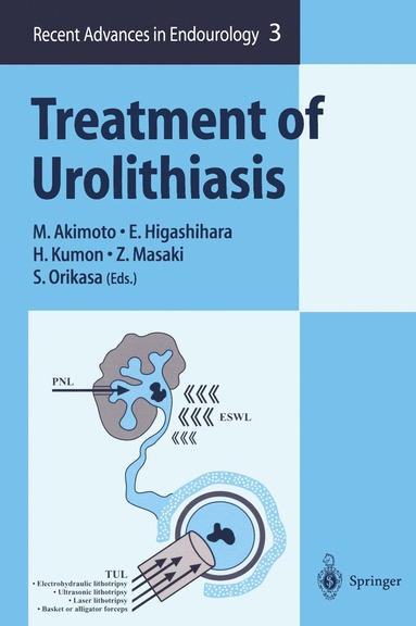 bokomslag Treatment of Urolithiasis